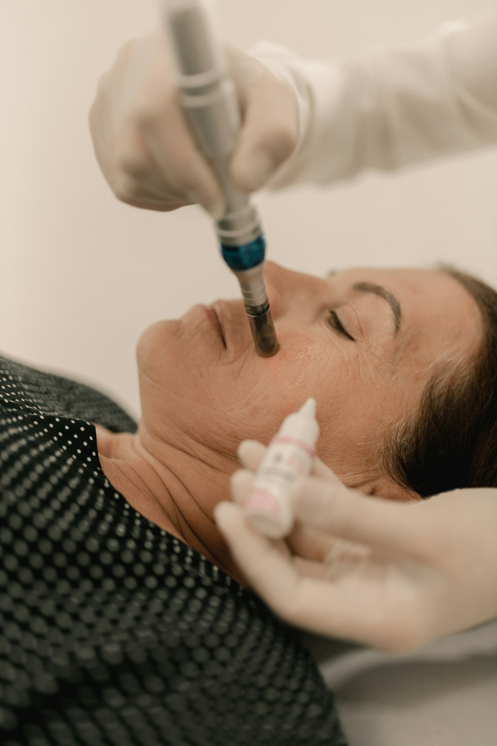 Tratamiento de endoláser facial en el rostro