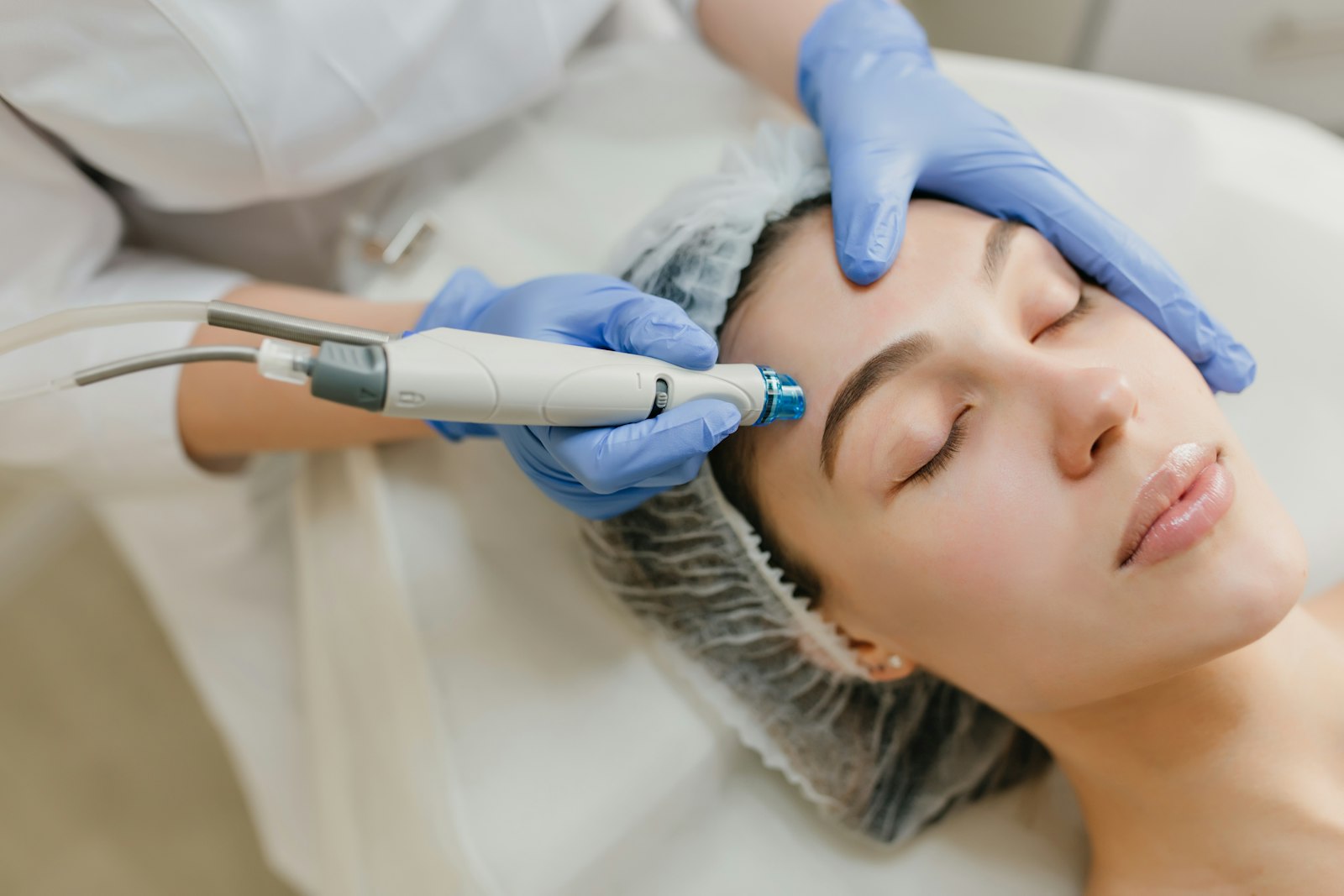 Tratamiento facial con láser Hollywood Peel